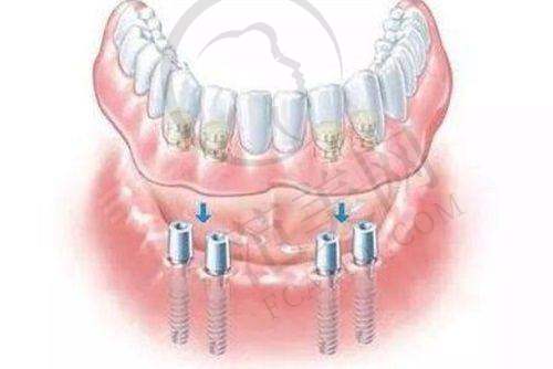 上海维乐口腔医院数字化口腔模式