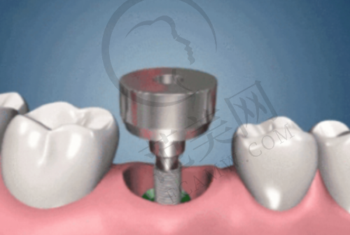 济南凯旋美奥口腔门诊部顾客实例