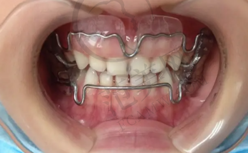 广州暨南雅皓口腔医院收费价格表顾客好评