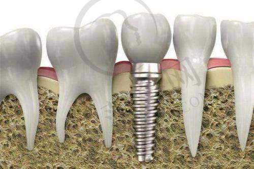 广州暨南雅皓口腔医院收费价格表优势分析