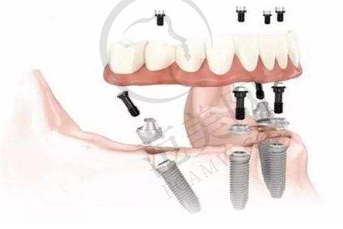 广州暨南雅皓口腔医院收费价格表未来趋势预测