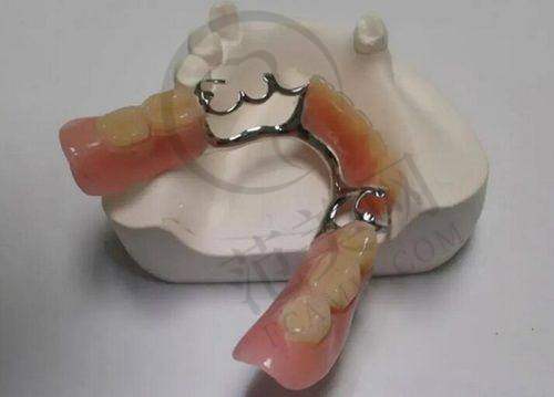 牙博士口腔收费价目表2025一览之正畸价格详情