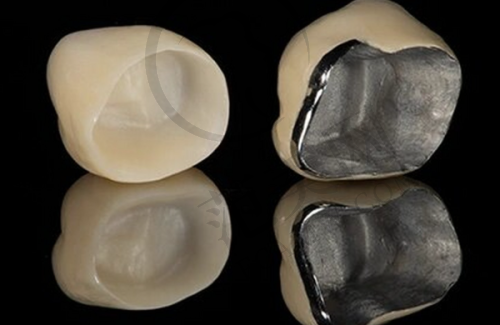 成都牙先森口腔:技术前列的看牙优选之地