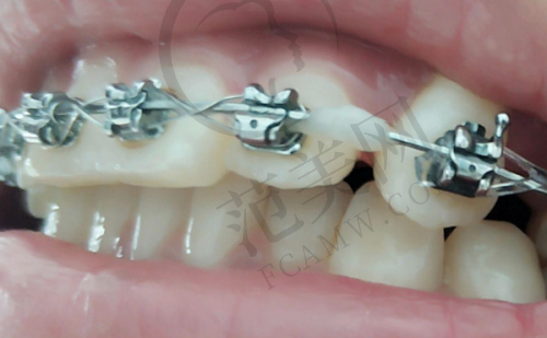 重庆名博士口腔医院:齐全服务与创新手段的代表