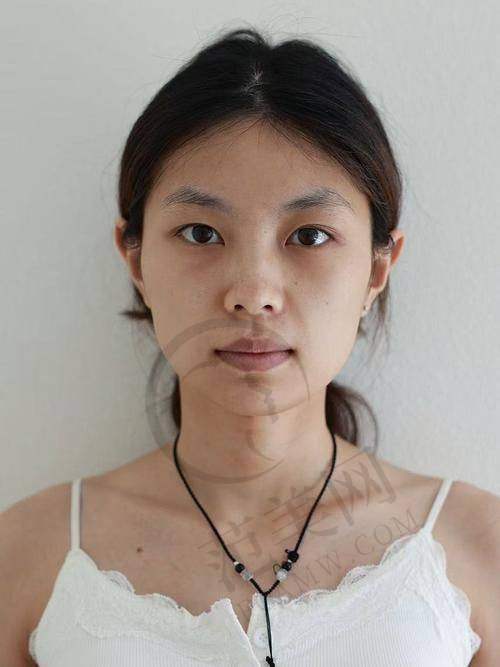 海口鹏爱整形特色项目