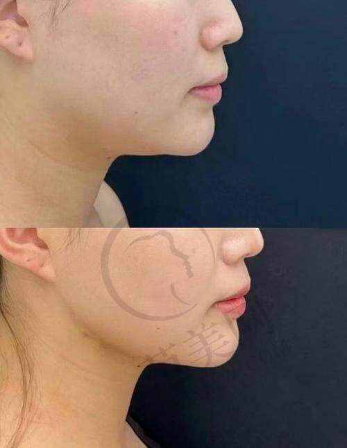 如何预约海口鹏爱整形医生