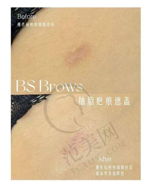 海口鹏爱整形是否正规靠谱